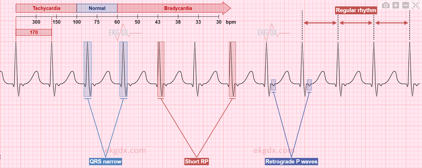 EKGDX - The new era of EKG learning